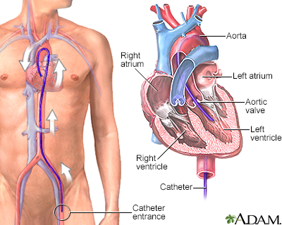 Main Arteries Of The Heart. arteries of the heart with