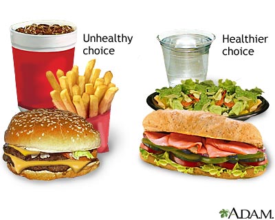 Fast Food Health on Fast Food Tips   Avera Health